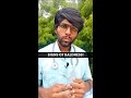 Baldness Symptoms in Male | Baldness Starting stage | Baldness Solution in Tamil #shorts #hairfall