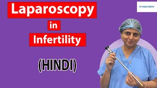 Role of Laparoscopy in Infertility for Getting Pregnant Fast Naturally |Hindi| Dr.Neera Bhan