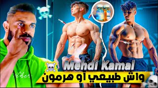 هل هم طبيعيون 🤔 : Mehdi Kamal واش طبيعي أو دوباج 💉