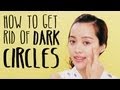 How to Get Rid of Dark Circles How to Get Rid of Dark Circles