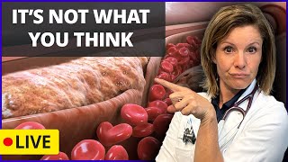 Do you have the Cholesterol that kills?