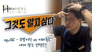 [모힐TV] 그것도 알고싶다 - ep.06 모발이식 vs 이마축소 내게 맞는 선택은?