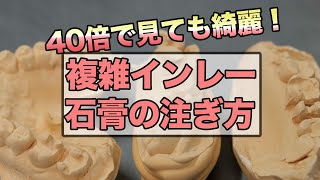 複雑なインレーの石膏の注ぎ方を知りたいですか？