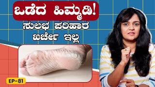 EP-81 | Cracked heels - ಮನೆಲೇ ಇರೋ ಈ 3 ಪದಾರ್ಥಗಳೇ ಮದ್ದು! | GSS MAADHYAMA