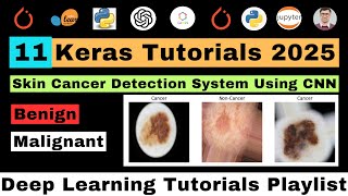 Building Skin Cancer Detection System Using CNN Deep Learning | Skin Cancer Diagnosis Using Python
