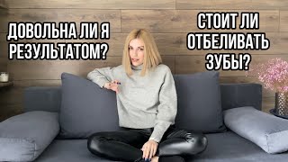 Отбеливание зубов | Мой опыт | Magic Smile или Beyond Polus?