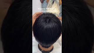 Alopecia Full Wigs @ 9951223066 #viral #wigs wigs #wigsforalopecia #cancerpatient #chemotherapy