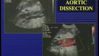 Ultrasound Evaluation of the Aorta and Peripheral Arteries