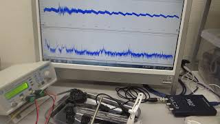 超音波実験：表面弾性波の伝搬状態が変化する様子を観察する実験（ultrasonic-labo）