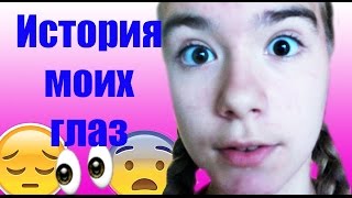 ПОЧЕМУ У МЕНЯ РАЗНЫЕ ГЛАЗА?/ История моего зрения/ Polina Terina