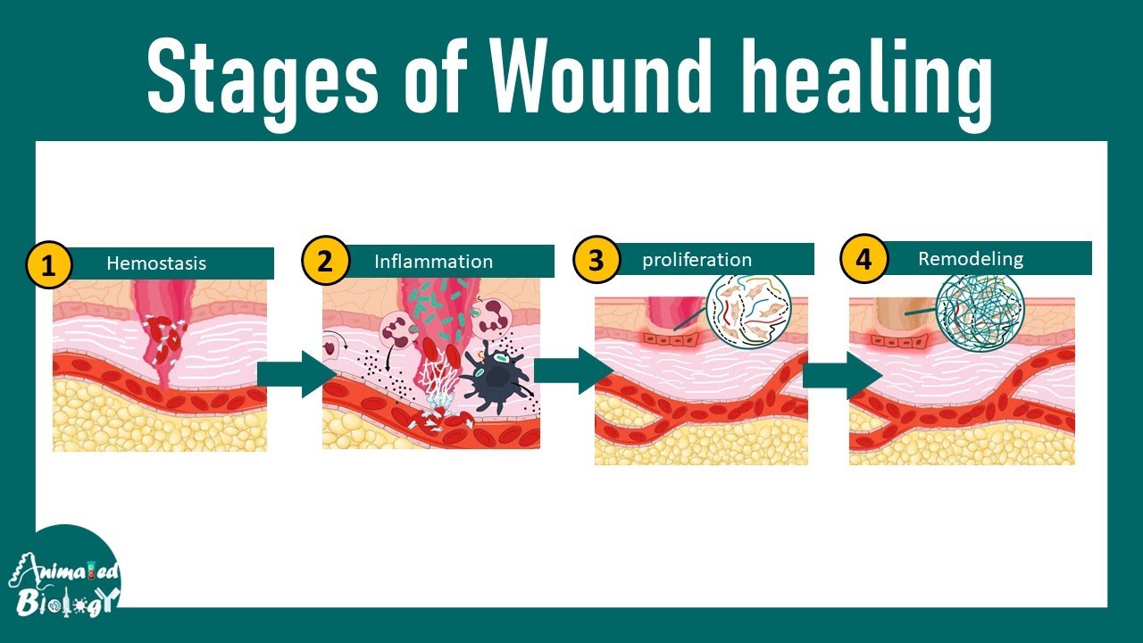 Pictures Of Wound Stages Wound Healing Process Tcztpr