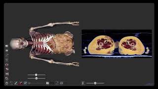 Mesa Virtual de Anatomia / Anatomage Table 6.0 - Tutorial Como localizar estruturas