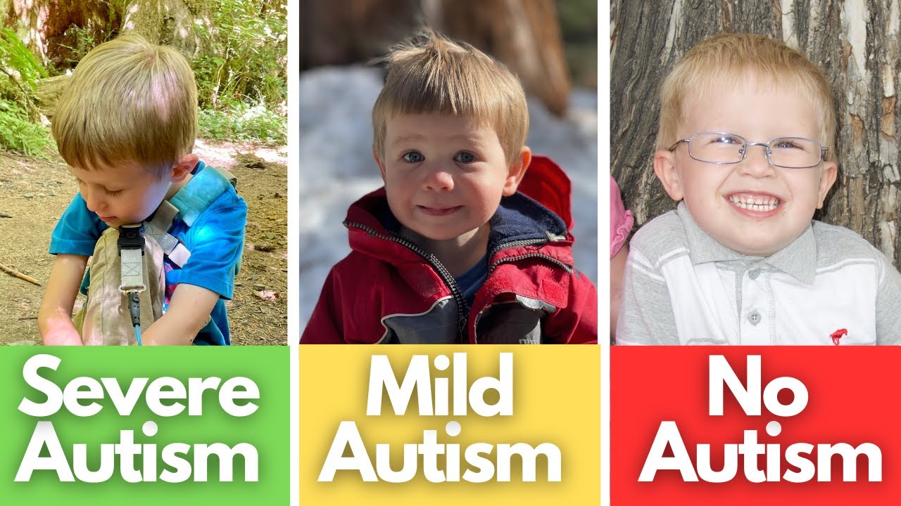 Signs Of Mild Autism, Severe Autism, No Autism | Compared - YouTube