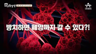 [예고] 전체 암 중 발병률 3위?! 숨통을 조여 오는 고통, 폐암! | 산전수전 여고동창생