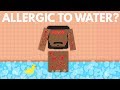 What Would Happen If You Were Allergic To Water?