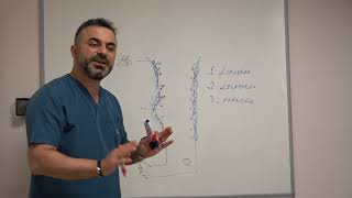 Tırnak Mantarı sonucu kötüleşen Bacakta Lenfödem ve Lipodem - Prof. Dr. Ahmet AKGUL