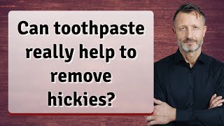 Can toothpaste really help to remove hickies?
