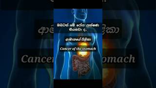 ඔබ ආමාශ පිලිකාවේ ලක්ෂණ ගැන දැනුවත්ද ? | do you know cancer of the stomach ? 😱|  #cancer