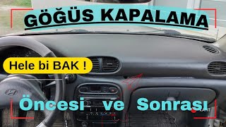 Hyundai Accent YUMURTA Kasa GÖĞÜS KAPLAMA #göğüskaplama Auto Chest Cover#çatlak #hyundaigöğüskaplama