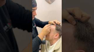 Adam Neill Mussell Planning | DRKAYA #hairclinic #hairlinetransplant #hairlossclinic