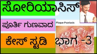 #psoriasis treatment in kannada cost of classical homeopathyಸೋರಿಯಾಸಿಸ್ಪೂರ್ತಿ ಗುಣವಾದ ಕೇಸ್ ಸ್ಟಡಿ ಭಾಗ3