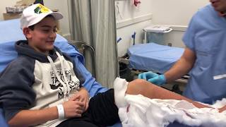 Does Cutting Off A Cast Hurt? No Big Deal!