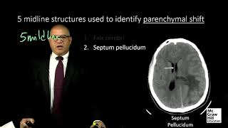 5 midline Structures