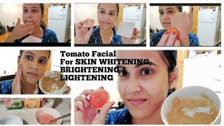 Tomato Facial 🍅For SKIN WHITENING, LIGHTENING \u0026 BRIGHTENING 😎|| Make Skin FAIR 😍w ||Avijeet