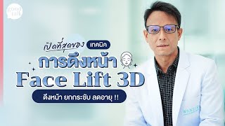 ดึงหน้า ย้อนวัย เด็กลง 10 ปี เทคนิค Face Lift 3D เฉพาะที่ โรงพยาบาลวรรณสิริ