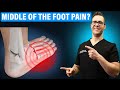 Lisfranc Injury Treatment & Recovery Time [Middle Foot Pain CURE!]