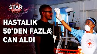 Afrika'da Yeni Bir Gizemli Hastalık Ortaya Çıktı Yüzlerce Vaka Tespit Edildi