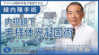 【手術解説】緑内障手術内視鏡下で毛様体光凝固術