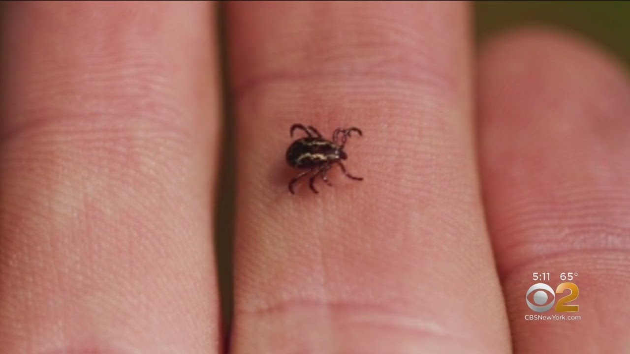 Lyme Disease Cases On The Rise - YouTube