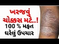 ખરજવું મટાડવા માટે | Eczema ka ilaj #kharajvu_Desi_Upchar#Gujaratihelthtips #GujaratiAyurvedicUpchar