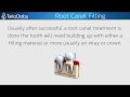 Root Canal Filling By Dr. Tariq Drabu