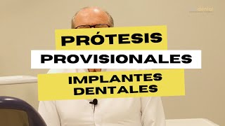 La importancia de los provisionales para los implantes dentales