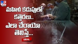 మహిళ కడుపులో కత్తెరలు.. ఎలా చేరాయో తెలిస్తే..-  TV9