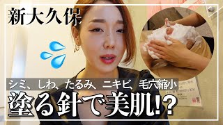 【新大久保】痛い美肌エステは効果抜群‼️塗る針マイクロニードルエステ受けてきた🔥【割引あり】