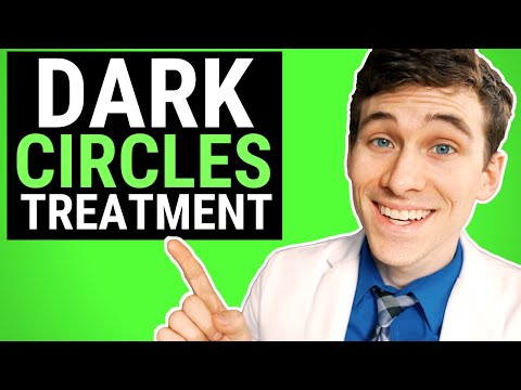 How to get rid of dark circles – 7 pro tips and natural remedies