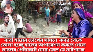 বাবা মায়ের চোখের সামনে  ক*বর থেকে তোলা হল হাতের অপারেশন করতে গেলে ডাক্তার পেটকেটে মে*রেফেল যেমাইশাকে