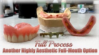 Full Process | Making Another Highly Aesthetics Full-Mouth Restoration