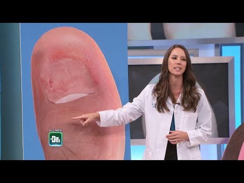 Do you need a toenail?