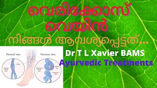 വേരിക്കോസ് വെയിൻ ലക്ഷണങ്ങളും ചികിൽസ രീതികളും | Ayurvedic Treatment for Varicose Veins Dr T L Xavier