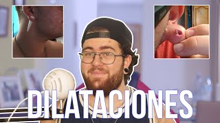 MI EXPERIENCIA CON DILATACIONES