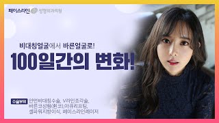 바른얼굴 윤여주의 양악수술 후 100일간의 변화 [페이스라인성형외과]