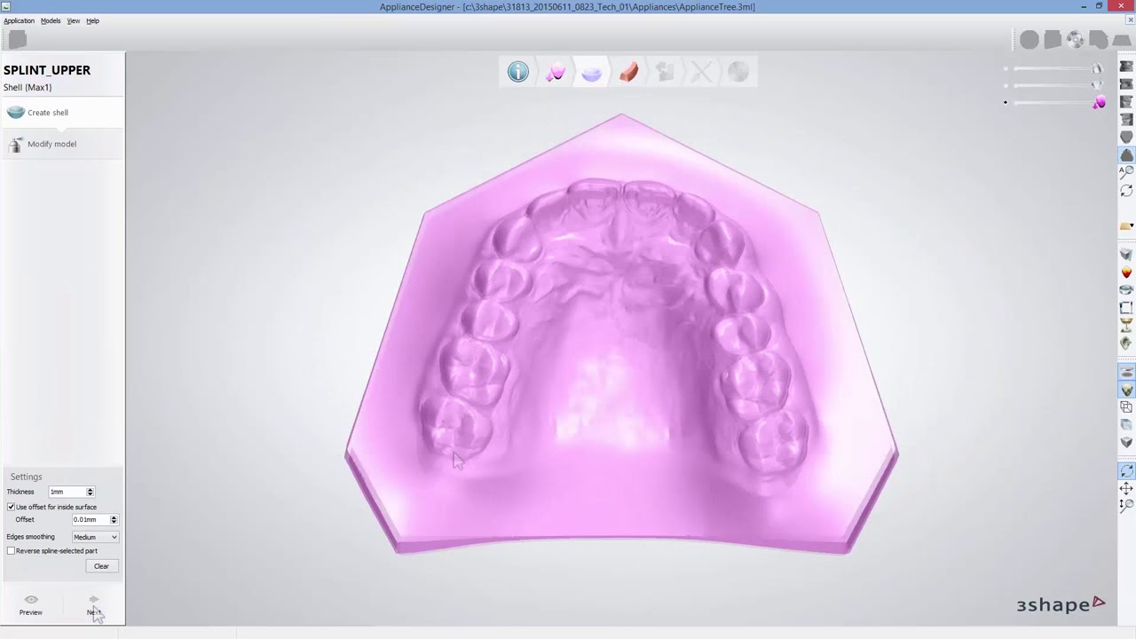 3DBioCAD - 3Shape Dental System Splint Design - YouTube