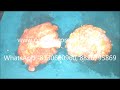 keyhole top surgery ftm mastectomy cost result testimonial delhi ncr india dr prabhash