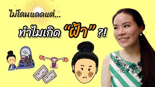 ไม่โดนแดด… ทำไมยังเกิด “ฝ้า” ?! ต้องรู้ | พี่หมอพาสวย Ep.6