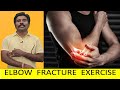 VADAPALANI PUTTUR KATTU | BEST ELBOW FRACTURE EXERCISE FOR QUICK IMPROVEMENT TAMIL Dr.R.S.VELUMANI