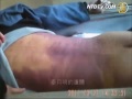 human abuse in jiamusi prison china 佳木斯监狱虐杀无辜的中国人 ..佳木斯监狱虐杀无辜的中国人